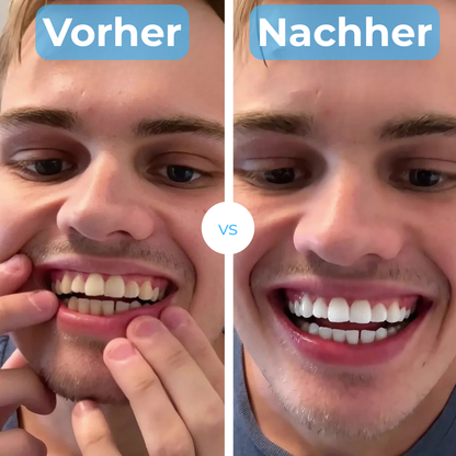 Splendora - für ein strahlendes Lächeln.